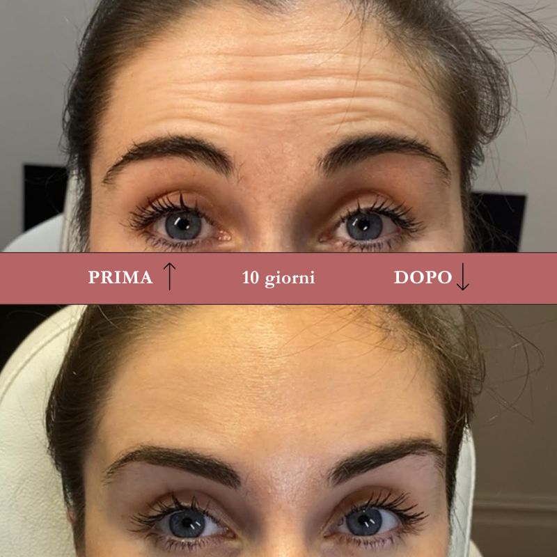 Crema Effetto Botox ai Peptidi Naturali