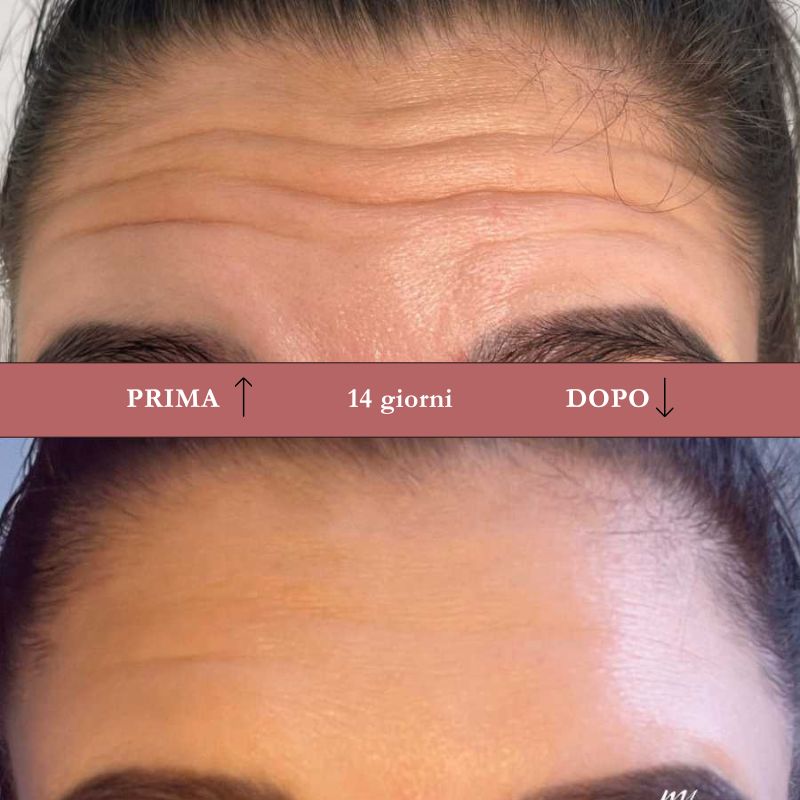 Crema Effetto Botox ai Peptidi Naturali